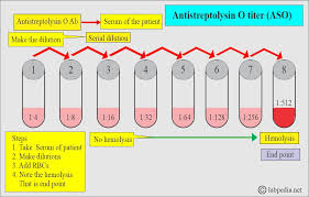 ASO TITRE ( ASO )